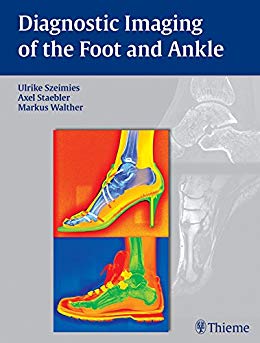 (eBook PDF)Diagnostic Imaging of the Foot and Ankle by Ulrike Szeimies , Axel Stbler , Markus Walther , Axel St＆auml;bler 