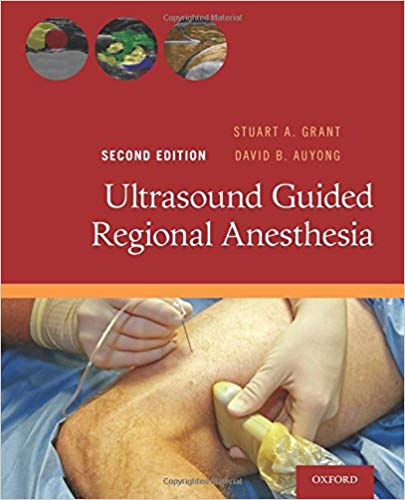 (eBook PDF)Ultrasound Guided Regional Anesthesia, 2nd Edition by Stuart A. Grant , David B. Auyong 