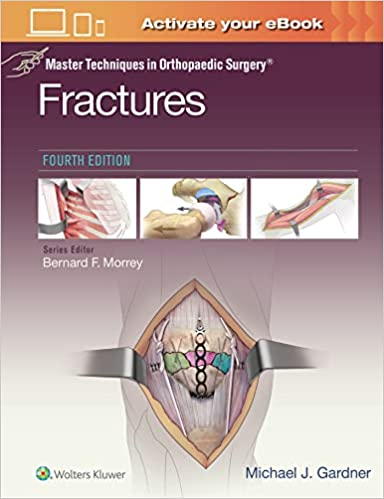 (eBook PDF)Master Techniques in Orthopaedic Surgery: Fractures 4e(epub+转换版 PDF) by Master Techniques in Orthopaedic Surgery