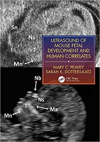 (eBook PDF)Ultrasound of Mouse Fetal Development and Human Correlates 1st Edition by Mary C. Peavey , Sarah K. Dotters-Katz 