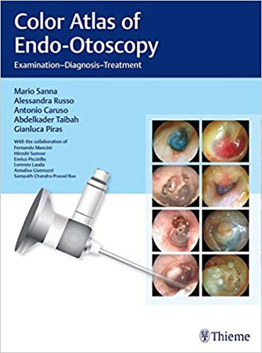 (eBook PDF)Color Atlas of Endo-Otoscopy - Examination-Diagnosis-Treatment by Mario Sanna , Alessandra Russo , Antonio Caruso , Abdelkader Taibah , Gianluca Piras 