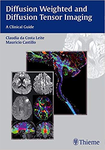 (eBook PDF)Diffusion Weighted and Diffusion Tensor Imaging by Claudia Leite , Mauricio Castillo 