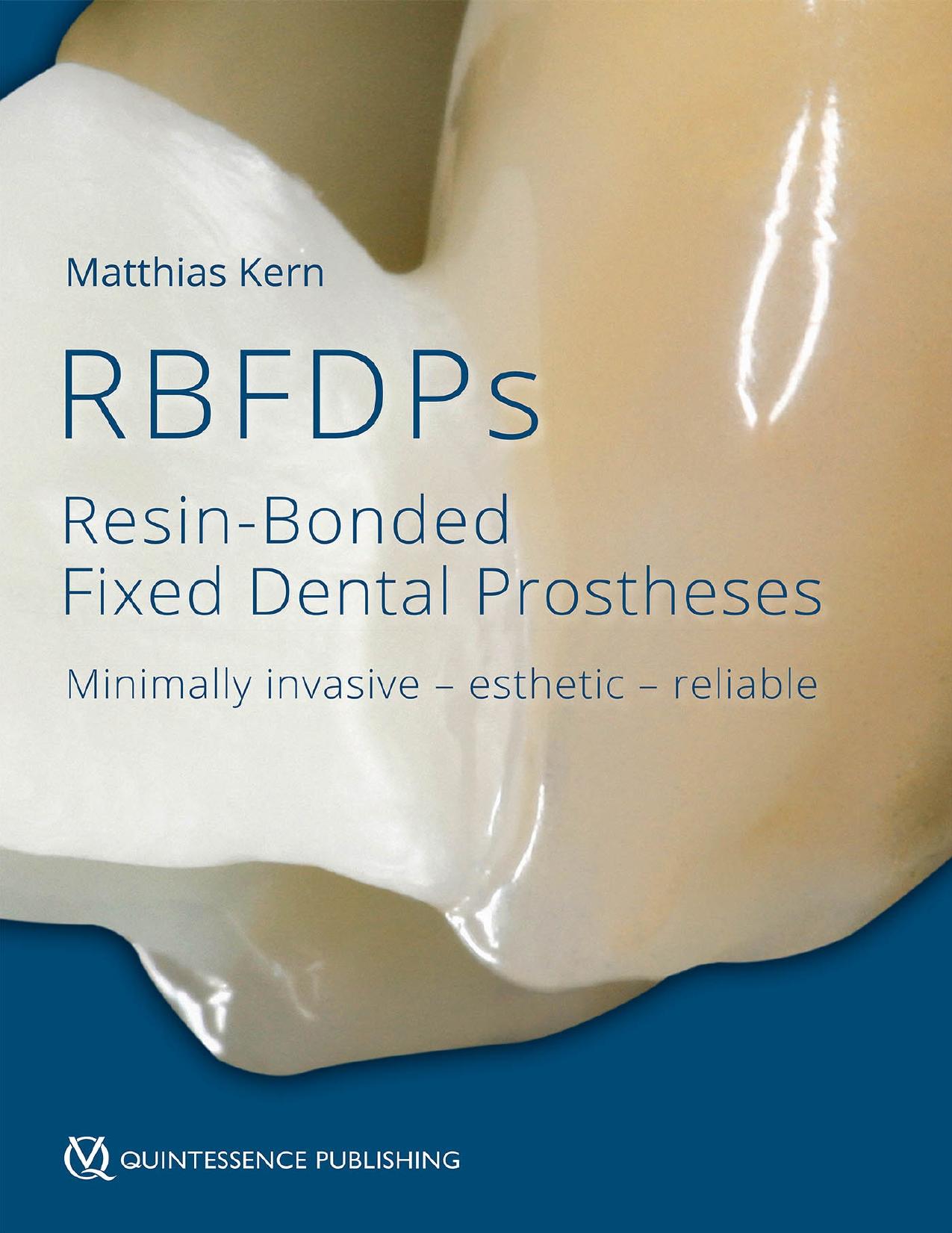 (eBook PDF)Resin-Bonded Fixed Dental Prostheses: Minimally invasive - esthetic - reliable 1st Edition by Matthias Kern