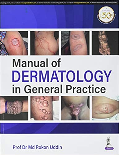 (eBook PDF)Manual of Dermatology in General Practice by Md Rokon Uddin 