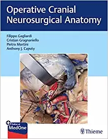 (eBook PDF)Operative Cranial Neurosurgical Anatomy by Filippo Gagliardi , Cristian Gragnaniello , Pietro Mortini 