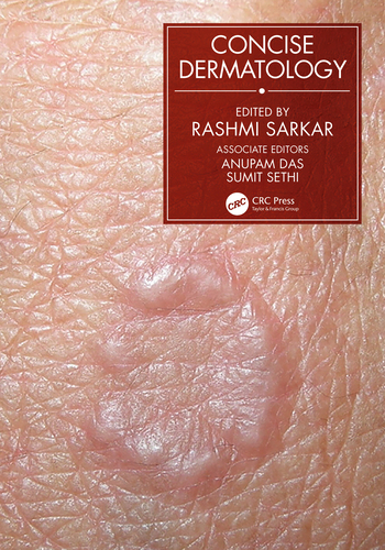 (eBook PDF)Concise Dermatology by Rashmi Sarkar