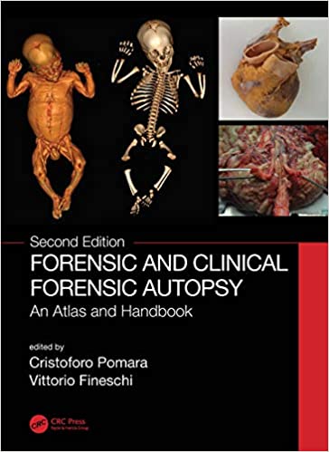 (eBook PDF)Forensic and Clinical Forensic Autopsy: An Atlas and Handbook 2nd Edition by Cristoforo Pomara , Vittorio Fineschi 