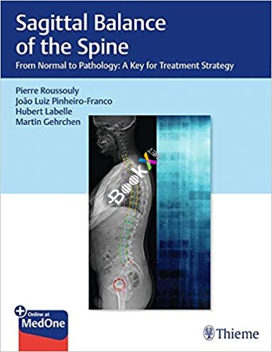 (eBook PDF)Sagittal Balance of the Spine: From Normal to Pathology by Pierre Roussouly , João Pinheiro-Franco , Hubert Labelle , Martin Gehrchen 