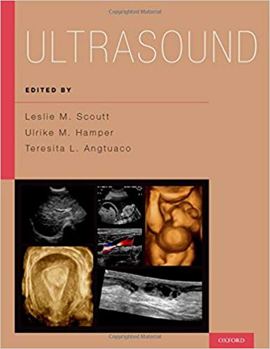 (eBook PDF)Ultrasound 
