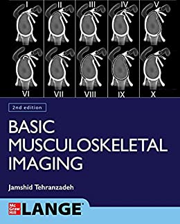 (eBook PDF)Basic Musculoskeletal Imaging, 2nd Edition by Jamshid Tehranzadeh 