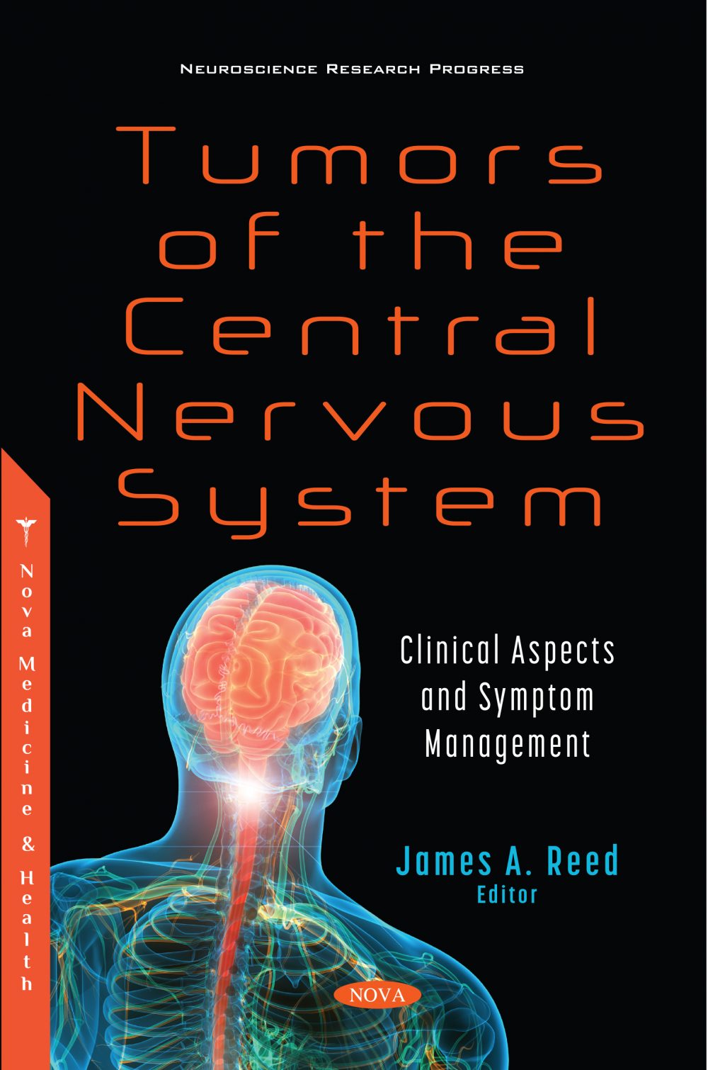 (eBook PDF)Tumors of the Central Nervous System Clinical Aspects and Symptom