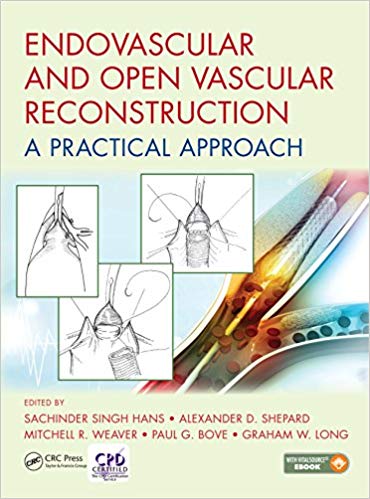 (eBook PDF)Endovascular and Open Vascular Reconstruction - A Practical Approach by Sachinder Singh Hans , Alexander D. Shepard , Mitchell R. Weaver , Paul Bove , Graham W. Long 