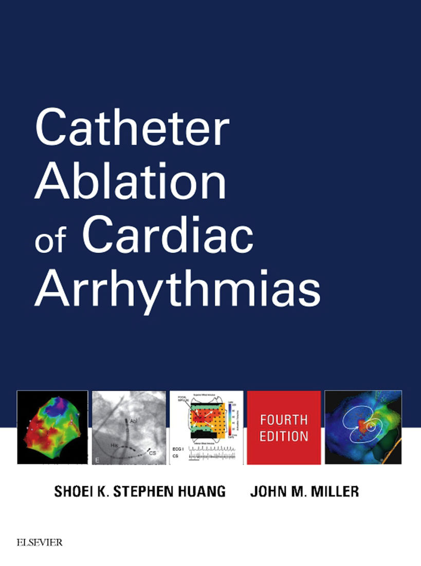 (eBook PDF)Catheter Ablation of Cardiac Arrhythmias 4th Edition by Shoei K. Stephen Huang MD , John M. Miller MD 