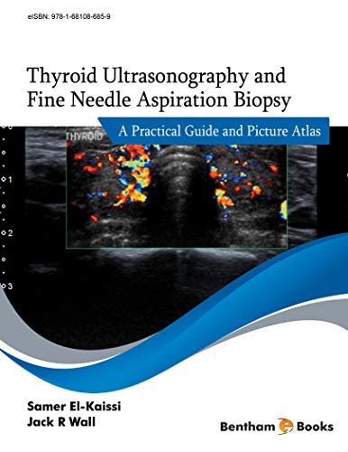 (eBook PDF)Thyroid Ultrasonography and Fine Needle Aspiration Biopsy by Samer El-Kaissi , Jack Wall 