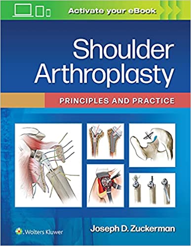 (eBook PDF)Shoulder Arthroplasty Principles and Practice  by Joseph D. Zuckerman MD