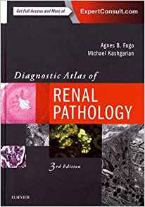 (eBook PDF)Diagnostic Atlas of Renal Pathology, 3e 3rd Edition by Agnes B. Fogo MD , Michael Kashgarian MD 