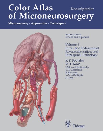 (eBook PDF)Color Atlas of Microneurosurgery Second Edition, Volume 3 Microanatomy, Approaches, Techniques by Wolfgang T. Koos , Robert F. Spetzler 