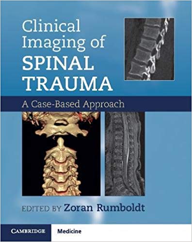 (eBook PDF)Clinical Imaging of Spinal Trauma by Zoran Rumboldt , Alessandro Cianfoni , Abhay Varma 