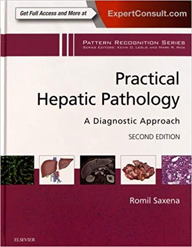 (eBook PDF)Practical Hepatic Pathology 2nd by Romil Saxena MD FRCPath 