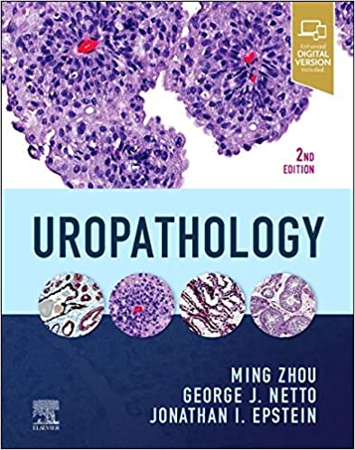 (eBook PDF)Uropathology 2nd Edition E-Book by Ming Zhou MD PhD , George Netto MD , Jonathan I Epstein 