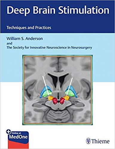 (eBook PDF)Deep Brain Stimulation: Techniques and Practices