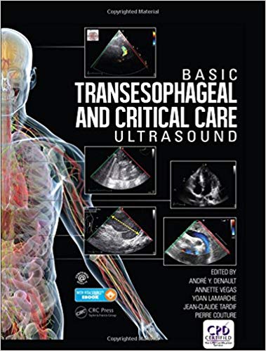 (eBook PDF)Basic Transesophageal and Critical Care Ultrasound by André Denault , Annette Vegas , Yoan Lamarche , Jean-Claude Tardif , Pierre Couture 