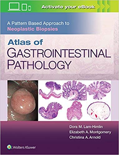 (eBook PDF)Atlas of Gastrointestinal Pathology: A Pattern Based Approach to Neoplastic Biopsies (PDF+EPUB) by Christina Arnold M.D. , Dora Lam-Himlin M.D. , Elizabeth A. Montgomery MD 