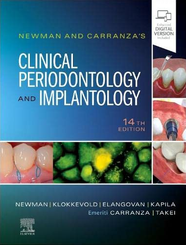 (eBook PDF)Newman and Carranza s Clinical Periodontology and Implantology 14th Edition by Michael G. Newman DDS  FACD,Michael G. Newman DDS  FACD