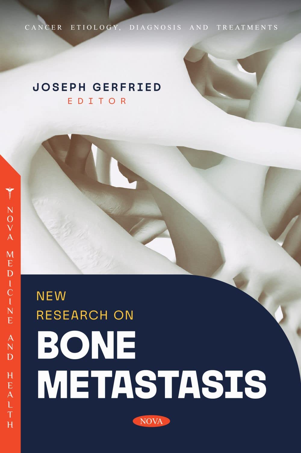 (DK   PDF)New Research on Bone Metastasis Paperback – May 3, 2023 by Joseph Gerfried 