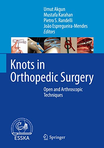 Knots in Orthopedic Surgery: Open and Arthroscopic Techniques (EPUB) by Umut Akgun 