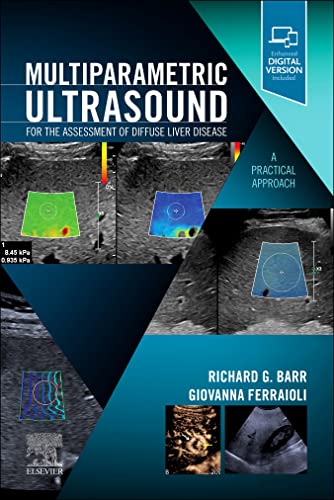 Multiparametric Ultrasound for the Assessment of Diffuse Liver Disease: A Practical Approach (Original PDF) by  Richard G. Barr 