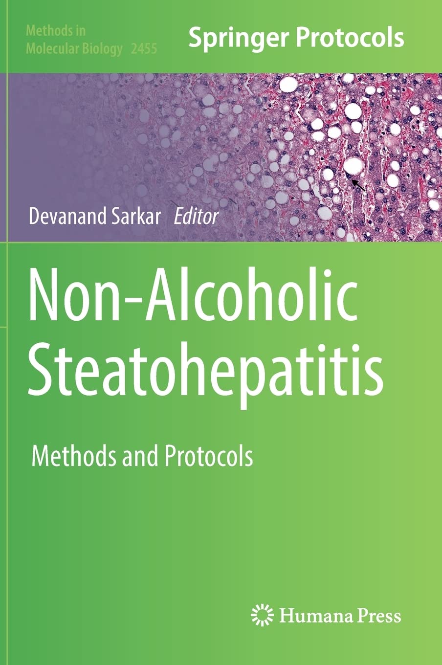 Non-Alcoholic Steatohepatitis: Methods and Protocols by Devanand Sarkar 