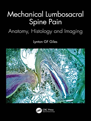Mechanical Lumbosacral Spine Pain: Anatomy, Histology and Imaging  by Lynton GF Giles 
