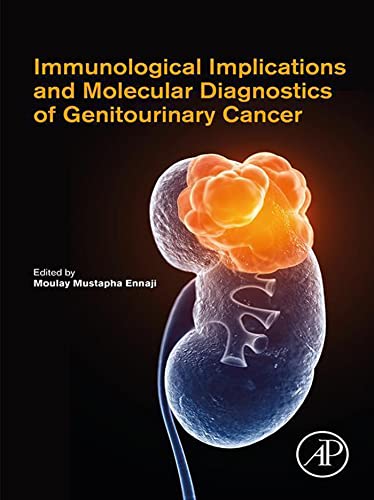 Immunological Implications and Molecular Diagnostics of Genitourinary Cancer  by Moulay Mustapha Ennaji