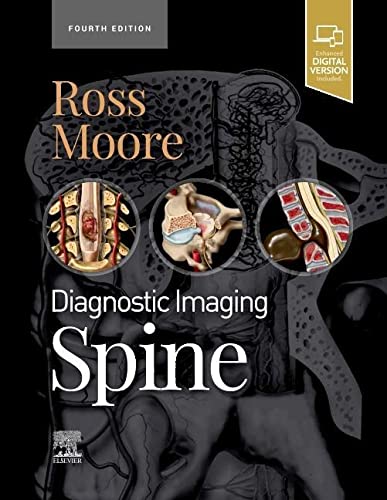 Diagnostic Imaging: Spine 4th Edition by Jeffrey S. Ross