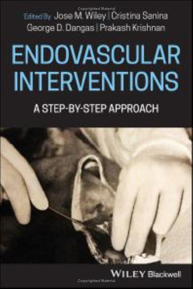 Endovascular Interventions: A Step-by-Step Approach  by Jose M. Wiley 