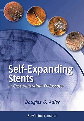 Self-Expanding Stents in Gastrointestinal Endoscopy by Douglas Adler