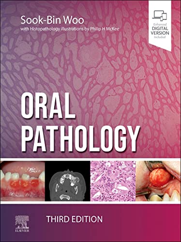 Oral Pathology, 3rd edition by Sook-Bin Woo DMD MMSc