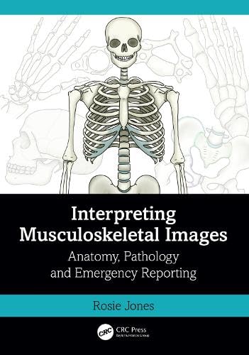 Interpreting Musculoskeletal Images: Anatomy, Pathology and Emergency Reporting   by Rosie Jones 