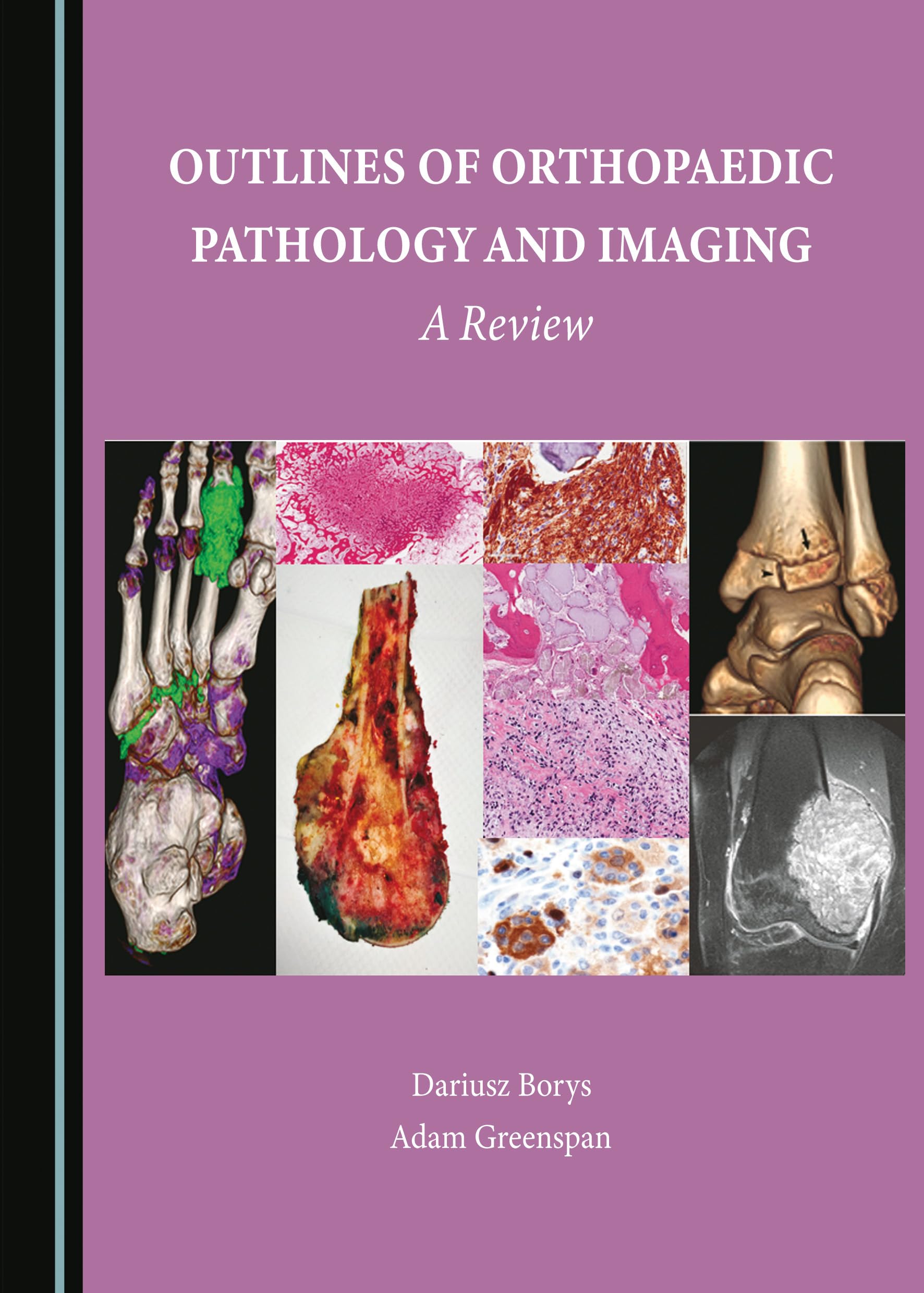 Outlines of Orthopaedic Pathology and Imaging: A Review by Dariusz Borys 