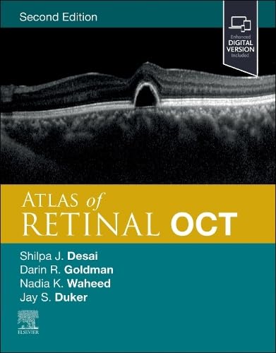 Atlas of Retinal OCT: Optical Coherence Tomography, 2nd Edition  by  Jay S. Duker MD (