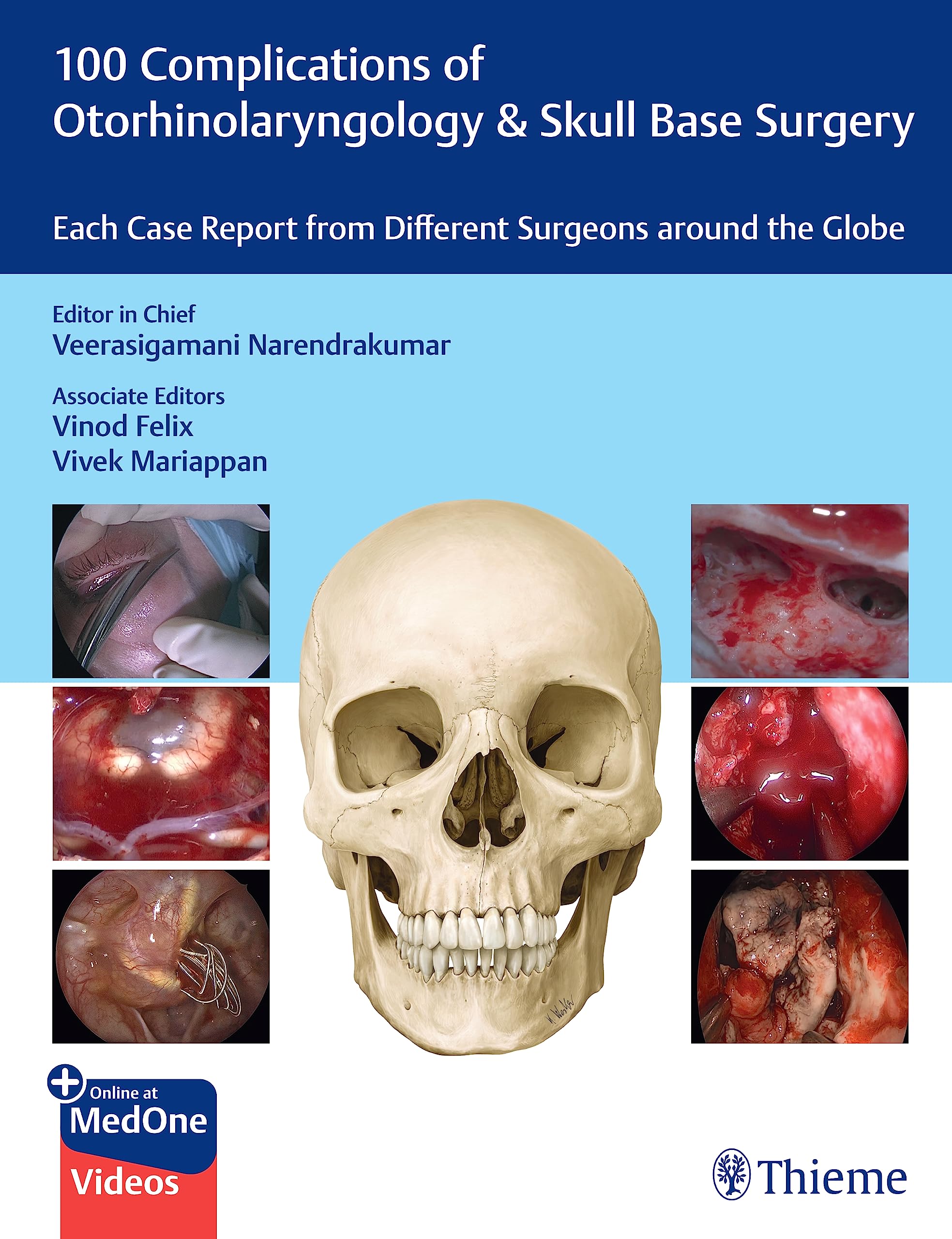 100 Complications of Otorhinolaryngology ＆amp; Skull Base Surgery by Veerasigamani Narendrakumar