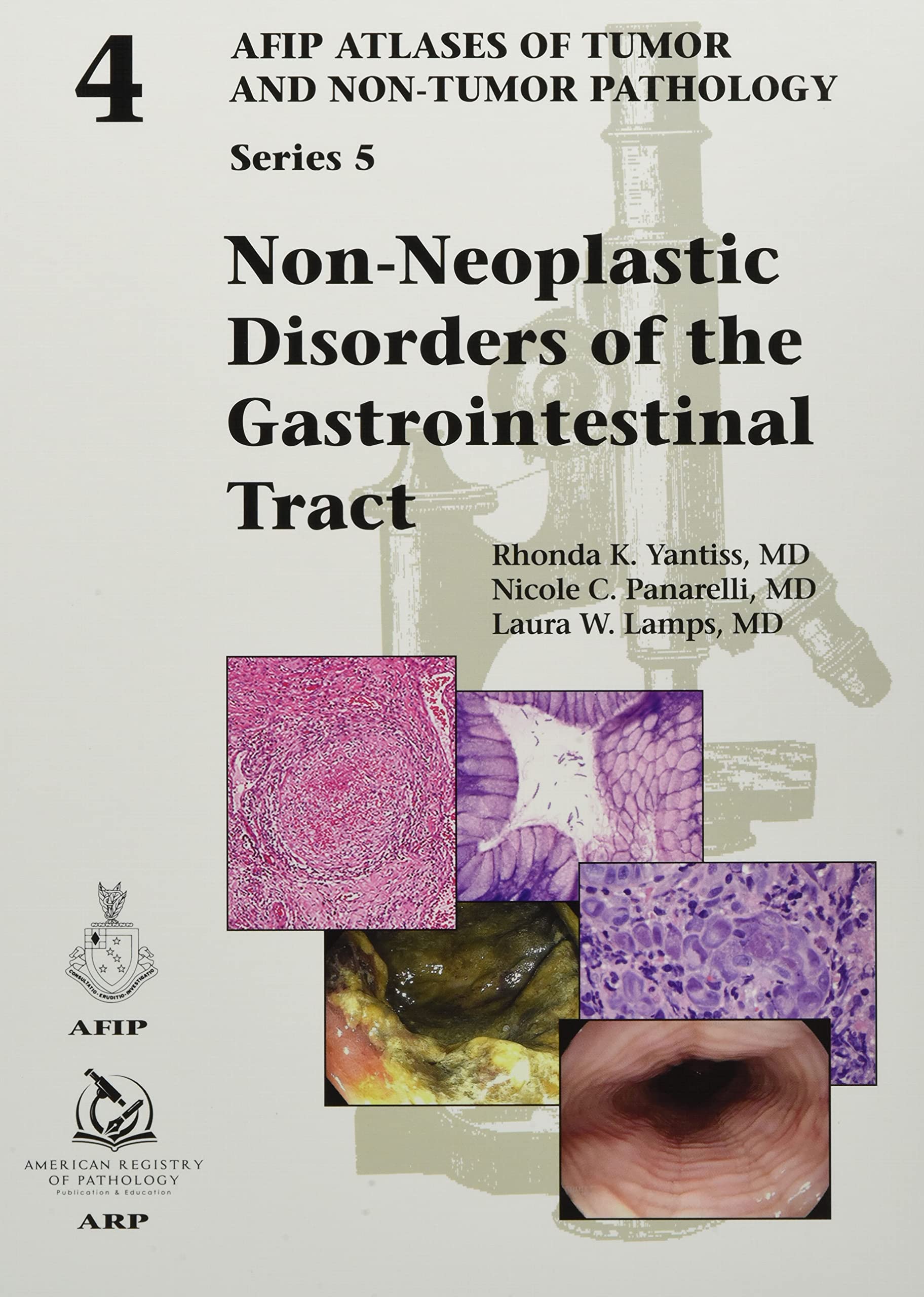 Non-Neoplastic Disorders of the Gastrointestinal Tract (AFIP Atlases of Tumor and Non-Tumor Pathology, Series 5) (Original PDF) by Rhonda K. Yantiss 