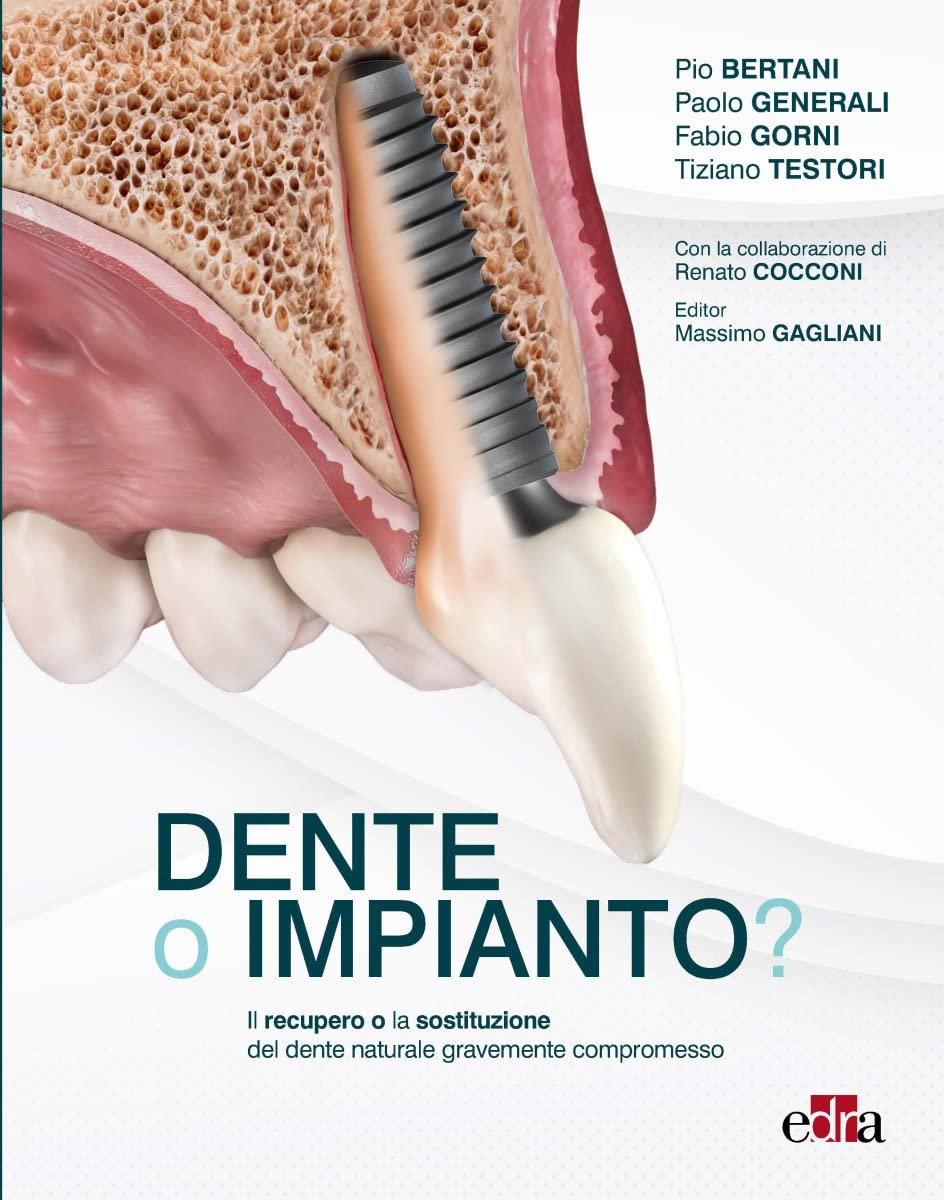 Dente o impianto? Il recupero e la sostituzione del dente naturale gravemente compromesso by Pio Bertani 