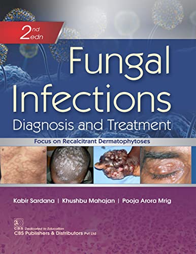 Fungal Infections Diagnosis and Treatment, 2nd edition by Kabir Sardana 