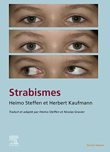 Strabisme  by Nicolas Gravier