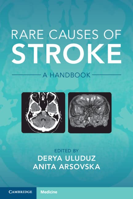 Rare Causes of Stroke: A Handbook by Anita Arsovska
