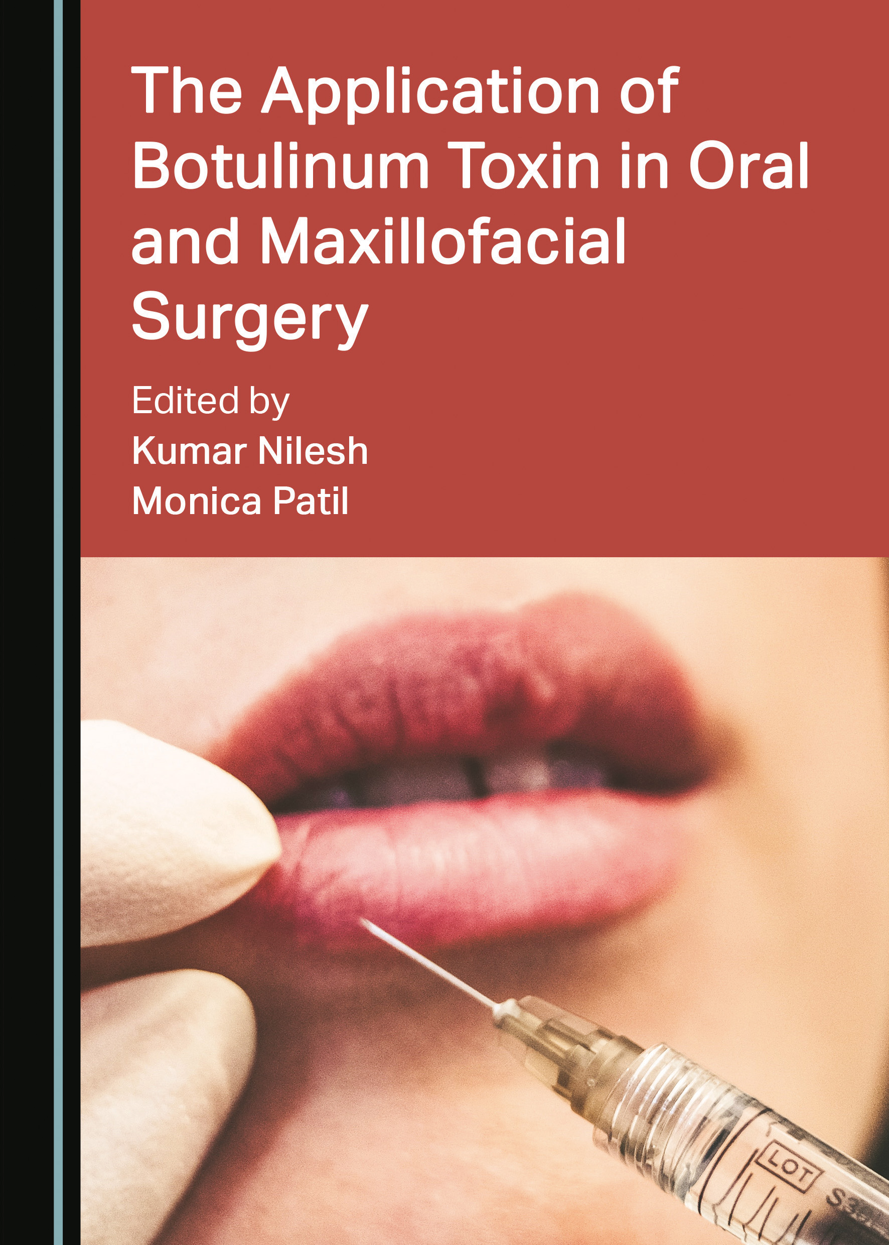 The Application of Botulinum Toxin in Oral and Maxillofacial Surgery by Kumar Nilesh, Monica Patil