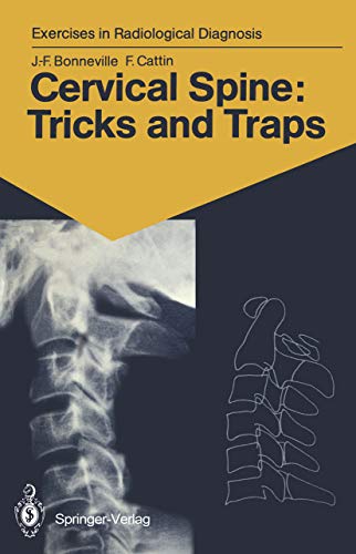 Cervical Spine: Tricks and Traps: 60 Radiological Exercises for Students and Practitionersby Jean-Francois Bonneville 