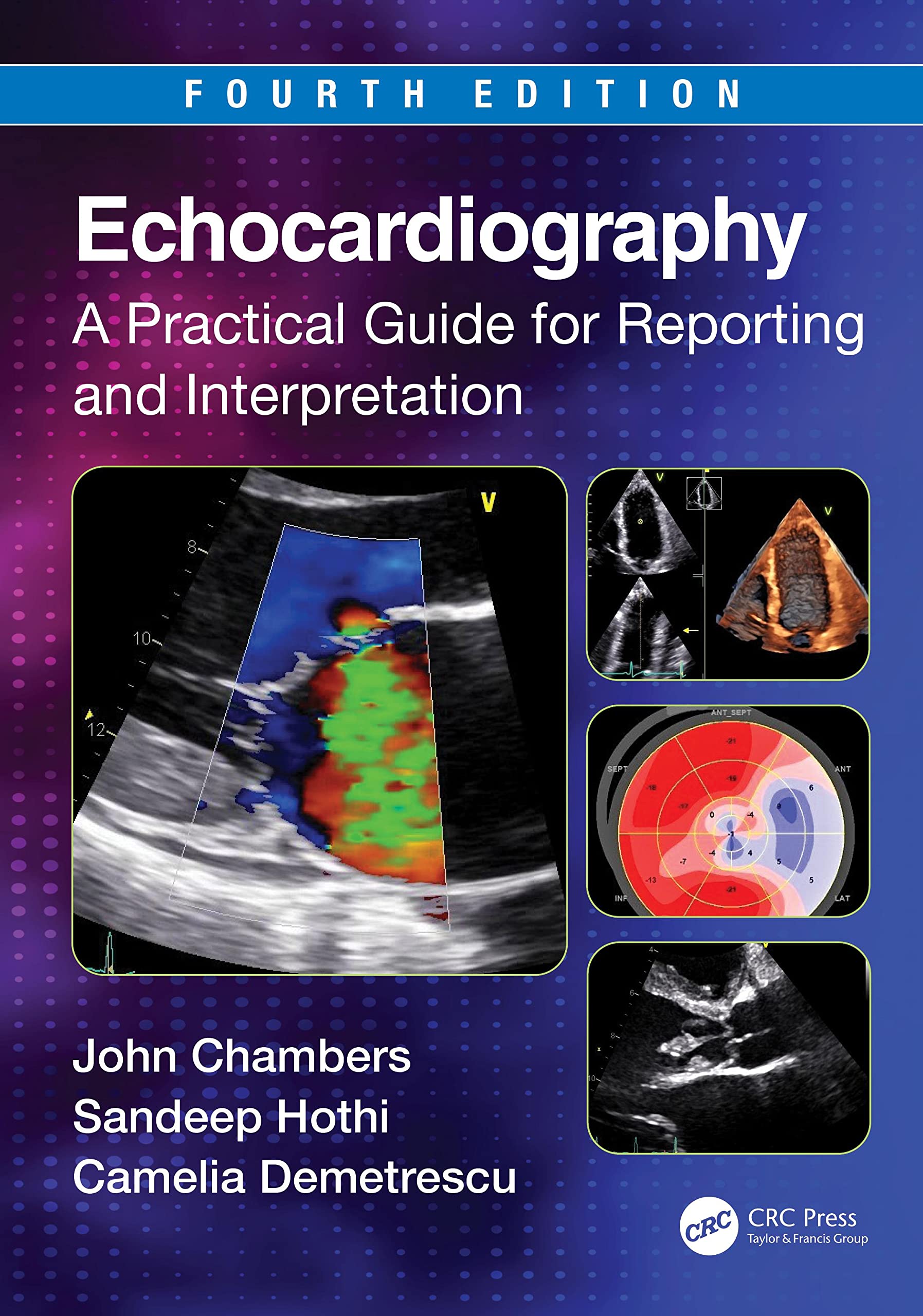 Echocardiography: A Practical Guide for Reporting and Interpretation, 4th Edition  by John Chambers 